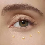 دابل سرم دور چشم کلارنس